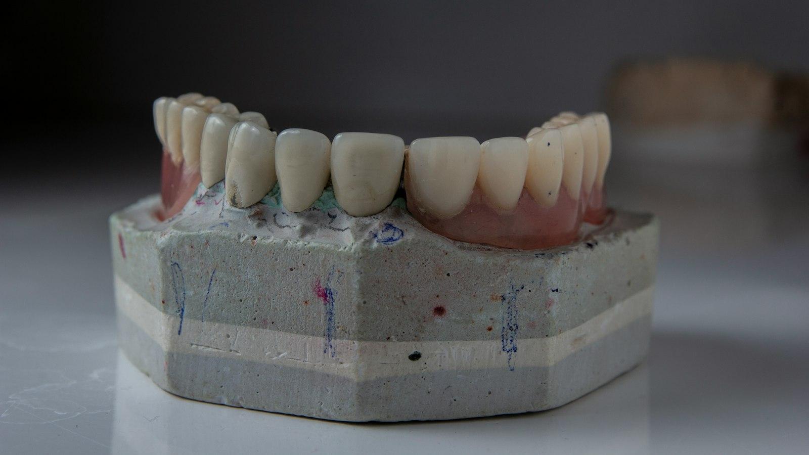 Clínica Dental Ciro Dentista En Madrid